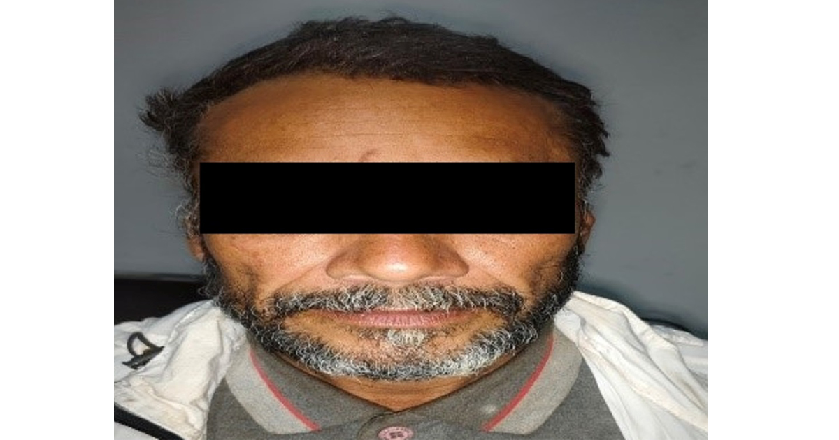 ढुंगा प्रहार गरी महिलाको हत्या