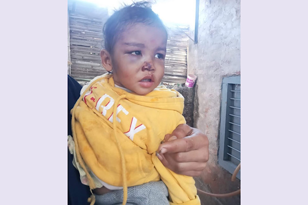 यि रहेछन् ती २ बर्षिय छोरी,जसलाई होटलमा छोडेर आमा भइन् बेपत्ता