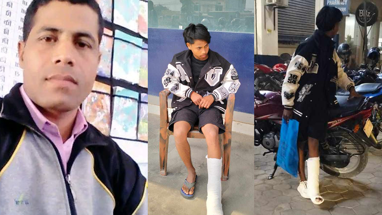 शिक्षकले बाटोमै कुटे विद्यार्थी, खुट्टा र छातीमा चोट