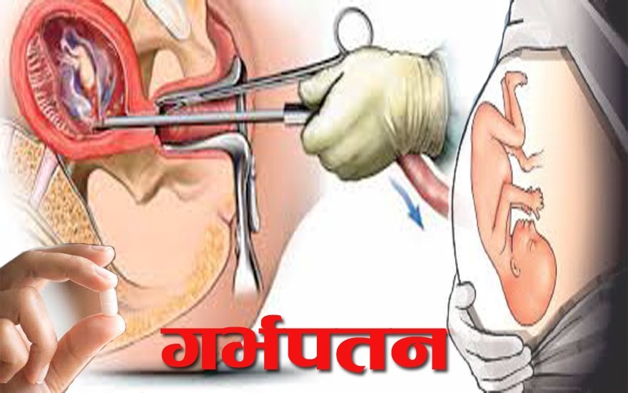 संविधानमै गर्भपतनको अधिकार दिने विश्वको पहिलो देश बन्यो फ्रान्स