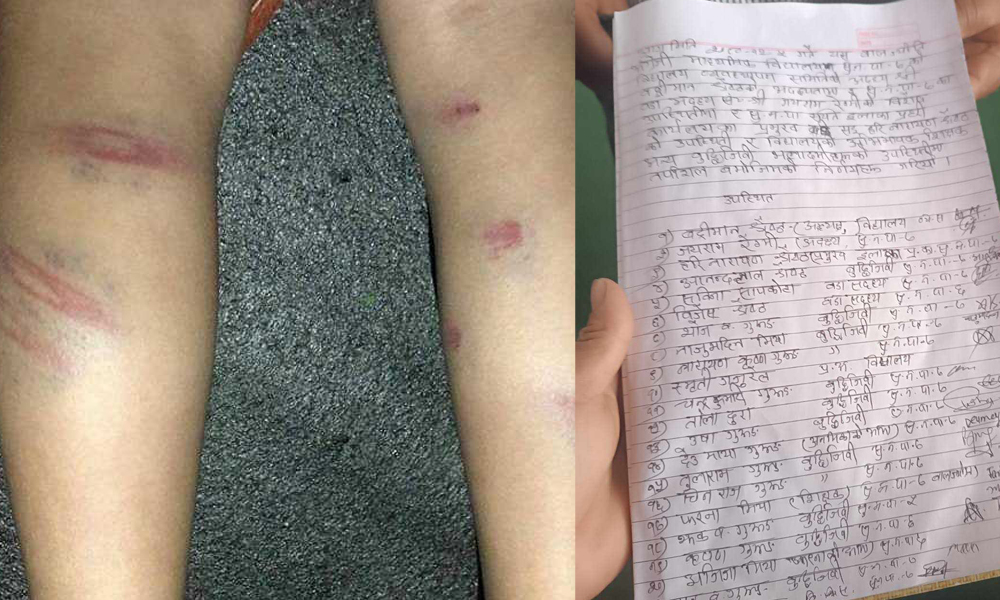 प्रश्नको उत्तर नजानेको भन्दै शिक्षिकाद्वारा छात्रामाथि कुटपिट