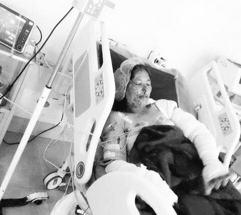 करेन्ट लागेर गम्भीर घाइते महिलाको मृत्यु
