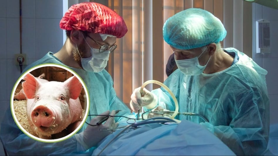 महिलाको शरीरमा सुँगुरको मृगौला प्रत्यारोपण, राम्रोसँग काम गरिरहेको डाक्टरको भनाइ