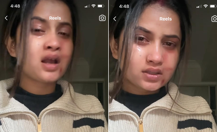 रुँदै गरेको भिडियोको विषयमा एलिना : गीत राम्रो लागेर भिडियो बनाएको हो