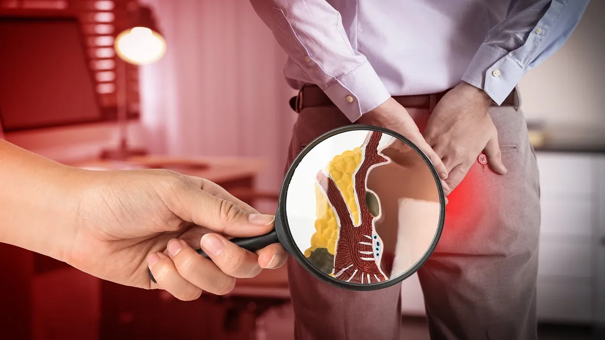 पायल्स के कारणले हुन्छ ?