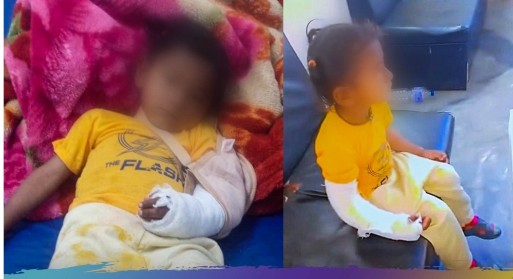 देब्रे हात भाँचिएका बालकको दाहिनेमा गरिदिए डाक्टपले प्लास्टर