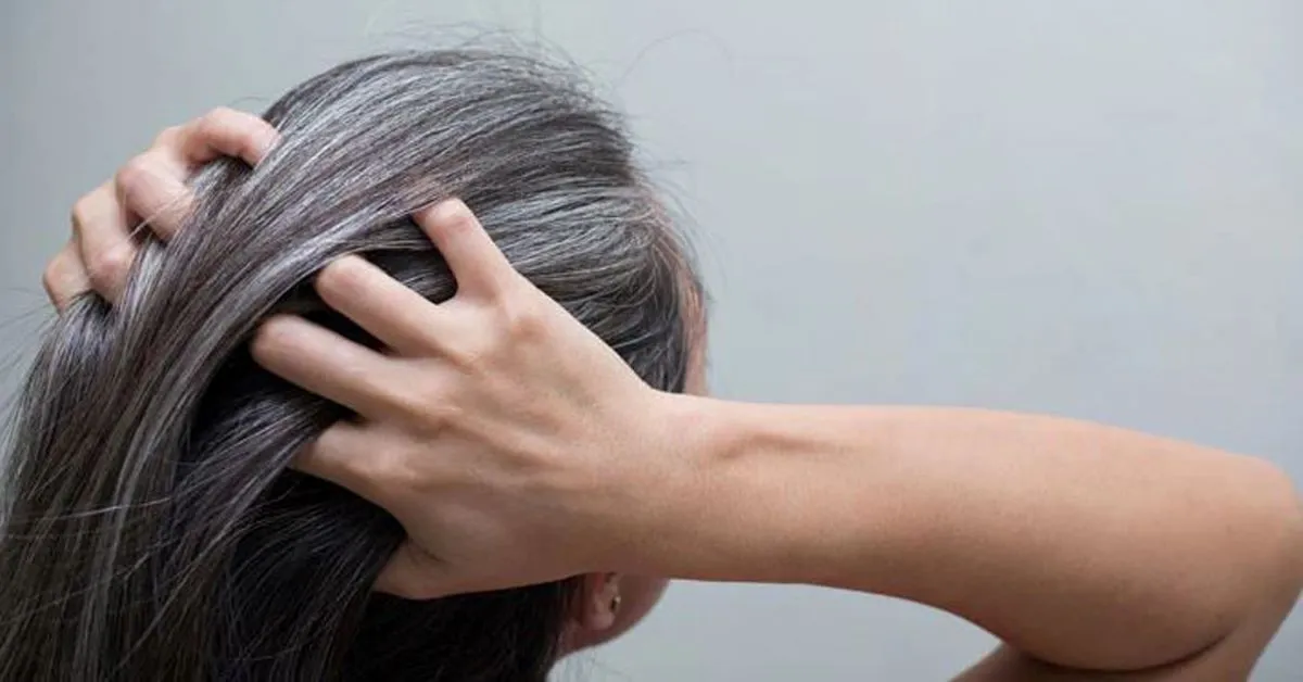 कपाल सेतो भएर हैरान हुनुहुन्छ ? कालो बनाउन अपनाउनूस यस्ता तरिका