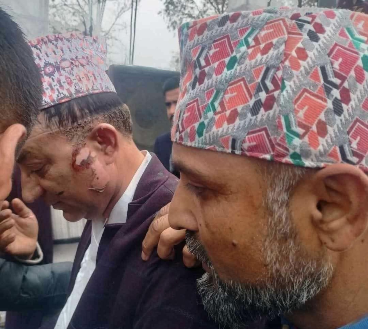 बेलुन पड्किएर घाइते भएका अर्थमन्त्री र मेयरलाई हेलिकप्टरमार्फत काठमाडौँ लगियो