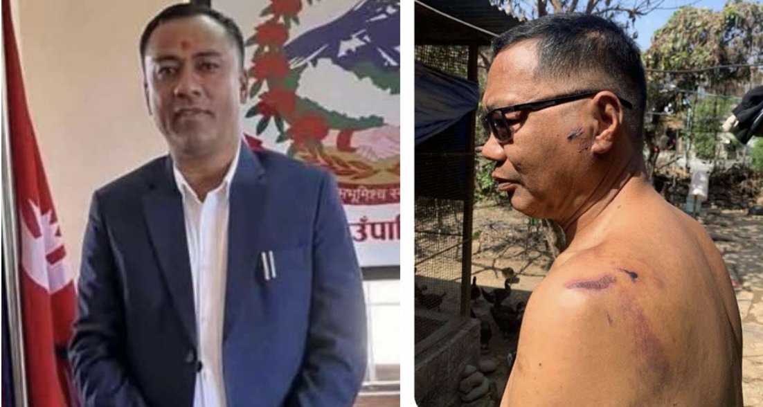 ऋषिङ गाउँपालिका अध्यक्षद्धारा पूर्वसांसदका छोरामाथि कुटपिट, प्रहरीले जाहेरी लिएन !