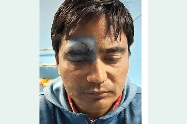 पत्रकार महासंघ बझाङका अध्यक्ष ललित सिंह माथि चक्कु प्रहार