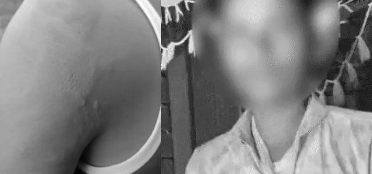 पानीको बोतल छोएको निहुँमा विद्यार्थीको औंला नै भांचिने गरि कुटिइएपछि…