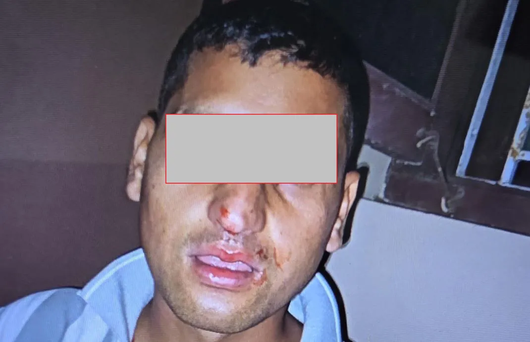 यसरी भयो तीन प्रहरी अधिकृतबिच कुटाकुट
