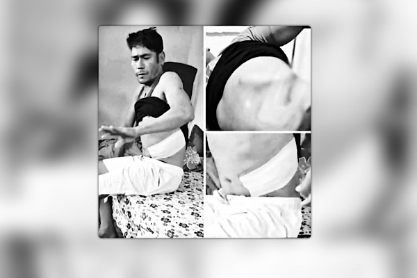 होटलमा काम गर्न भनेर भारत लगेर मिर्गौला निकालिएको घटना सार्बजनिक, पीडित खोज्दै प्रहरी