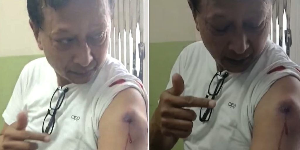 कान्तिपुर टिभीका पत्रकार श्रेष्ठलाई लाग्यो  रबरको गोली