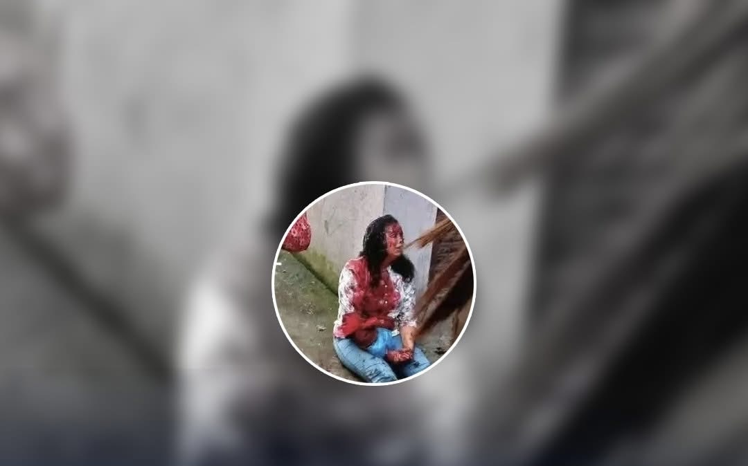 काठमाडौको गोकर्णेश्वरमा खाना खाइरहेकी एक महिलामाथि हतियार प्रहार