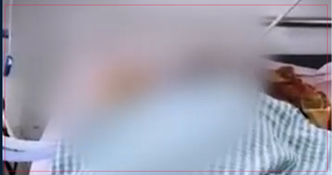 चिकित्सकले मृत घोषणा गरेको व्यक्ति जब बौरियो