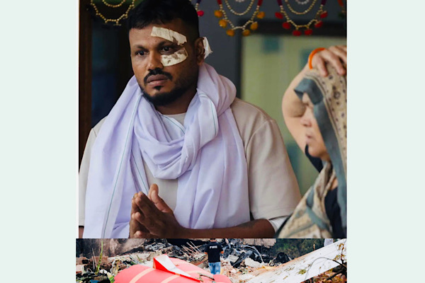 विमान दु’र्घट’नामा २४१ जनाको मृ’त्यु हुँदा भाग्यले बाँचेका एकमात्र जीवित यात्री  रमेश भन्छन्, “म एक्लै बाँचे,मलाई अहिलेसम्म विश्वास लागिरहेको छैन