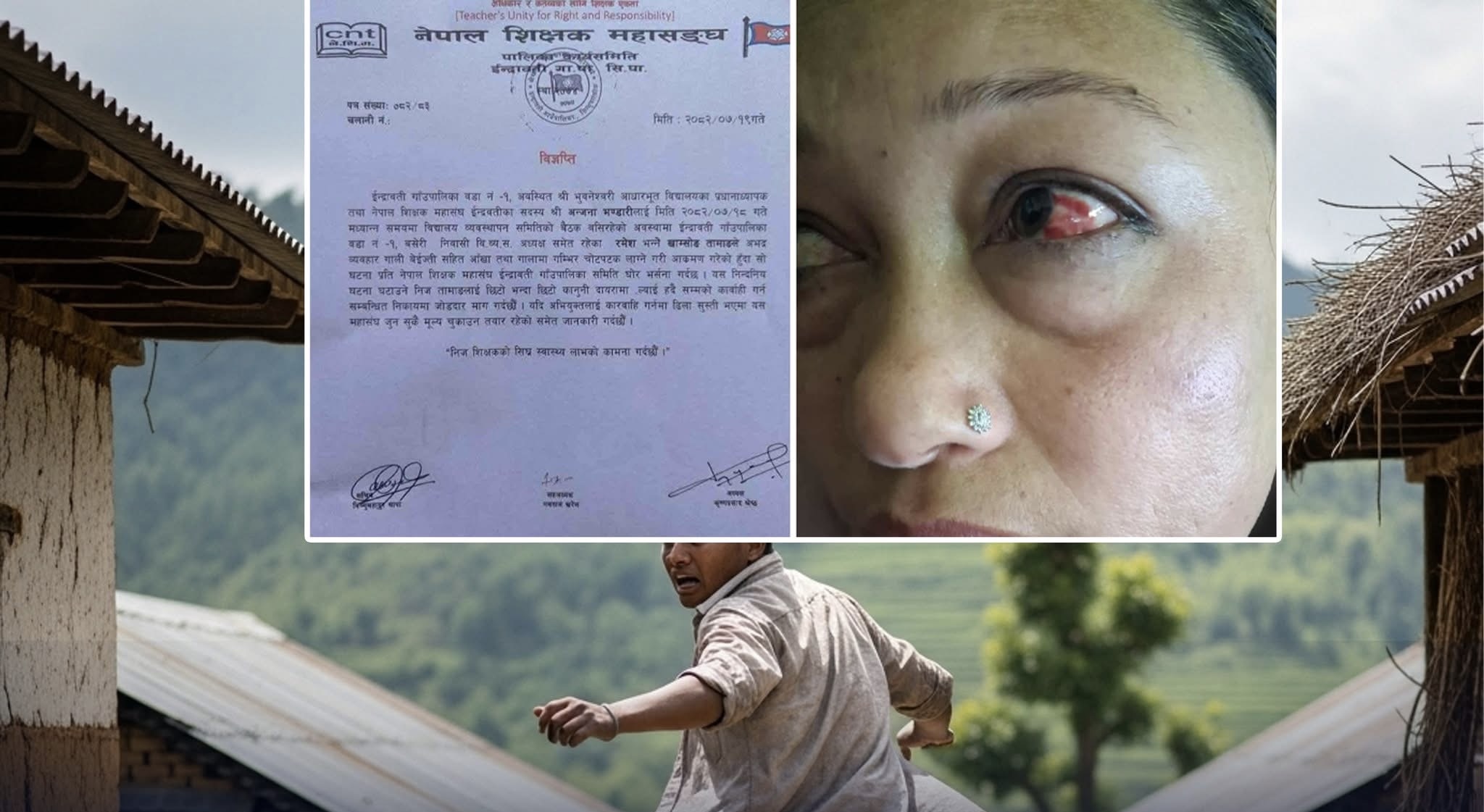 प्रधानाध्यापकलाई कुट्ने बिद्यालय ब्यवस्थापन अध्यक्ष फरार