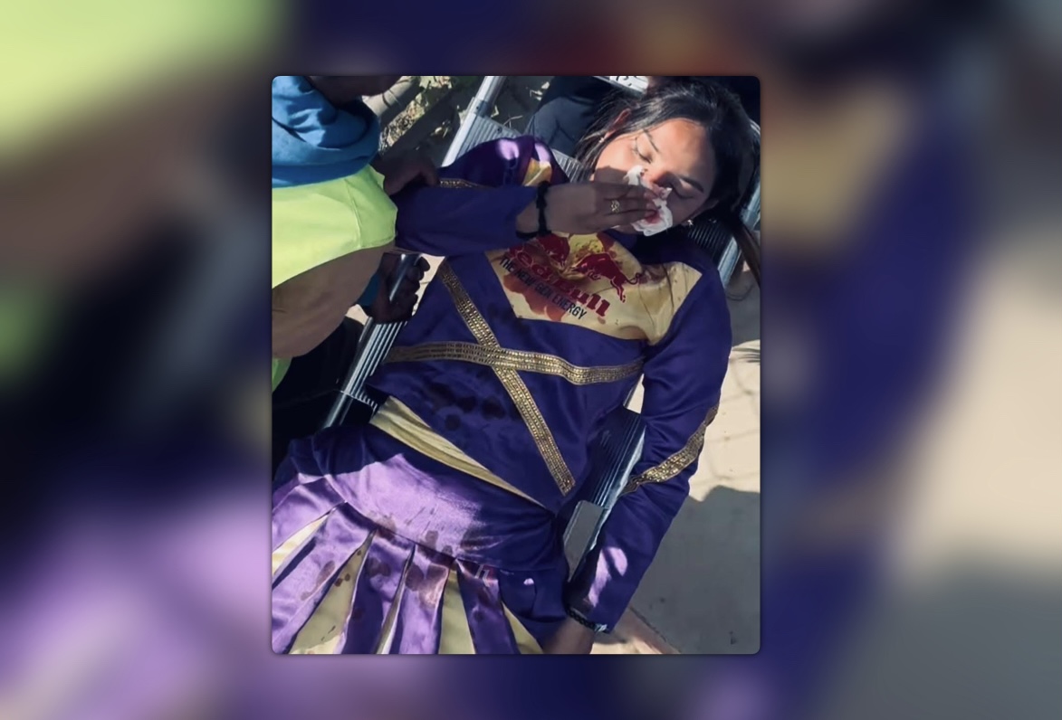 कुशल मल्लले छक्का हान्दा चियर लिडर घाइते