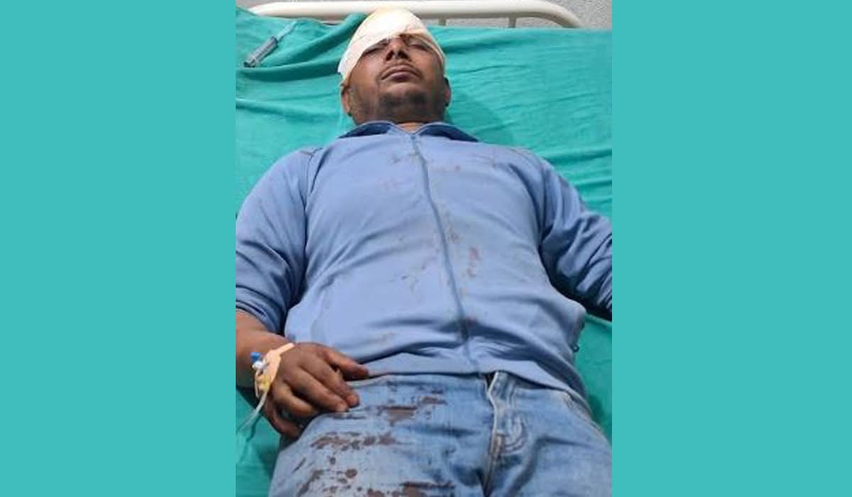घरदैलो कार्यक्रममा एमाले-रास्वपा झडप, युवा संघसँग आबद्ध  दुई जना घाइते