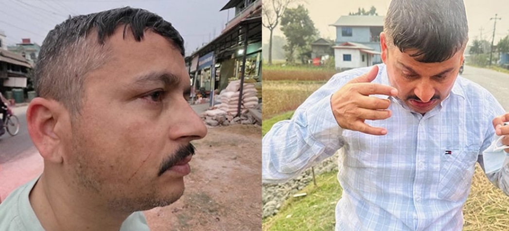 पत्रकार अर्जुन आचार्यमाथि नेकपा एमालेका कार्यकर्ताहरूले गरे आक्रमण