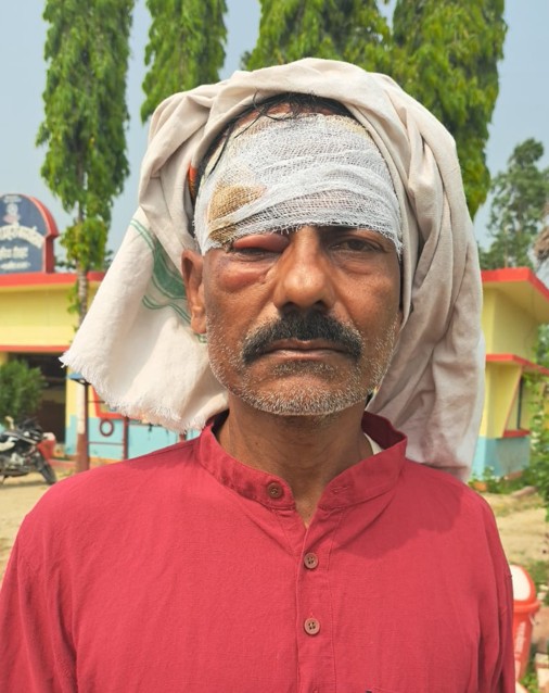 झगडा छुट्याउन गएका अध्यक्षमाथि रौतहटमा निर्घात कुटपिट
