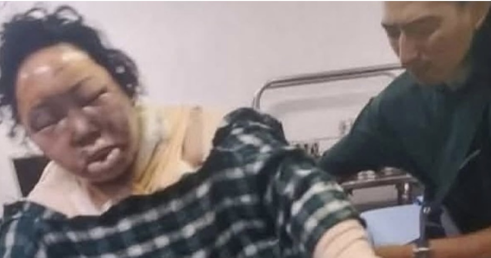 श्रीमानसँग झगडापछि शरीरमा आगो लगाएकी सालु गुरुङको निधन, माइतीले लगे शव